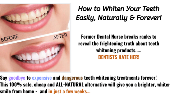 Whiten Your Teeth Easily