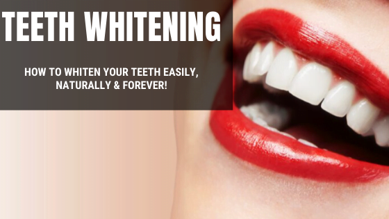 How to Whiten Your Teeth Easily, Naturally & Forever!