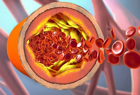 True Facts About Cholesterol Levels - cholesterol levels what is normal